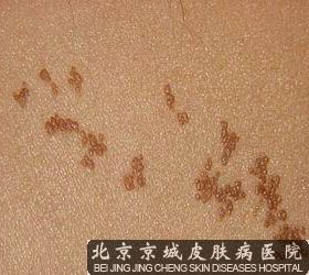 线状苔藓图片