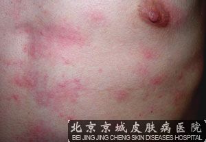 哪里的皮肤病较好