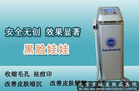 黑脸娃娃