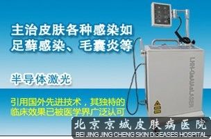半导体激光